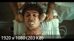 ������ (1 �����/2026/WEB-DL/1080p)